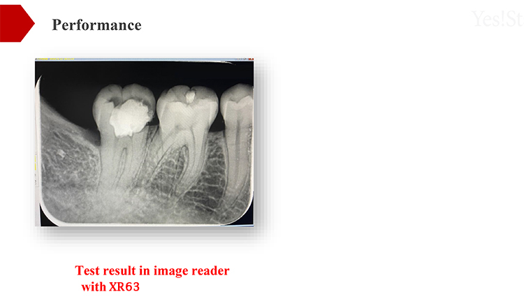 XR63 Phosphor Plates